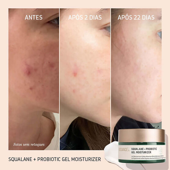 SQUALANE  + PROBIOTIC GEL MOISTURIZER V2